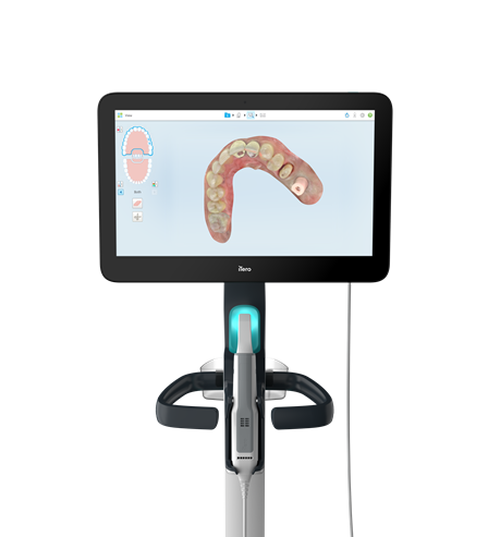 iTero - Product - Digital Screen 5D